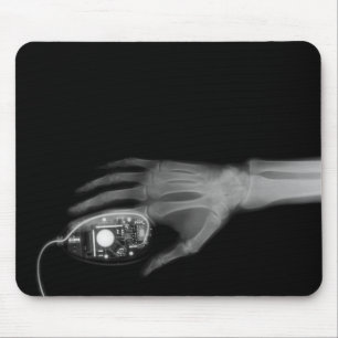 X-Ray Hand & Computer Mouse Pad