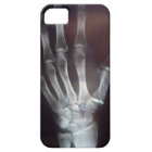 X Ray Hand Phone Case