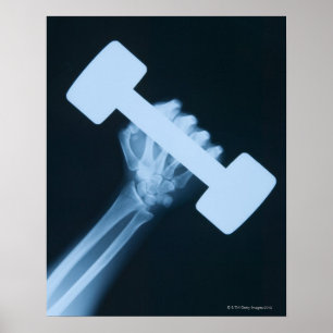 X-ray image of human hand with weight, close-up poster