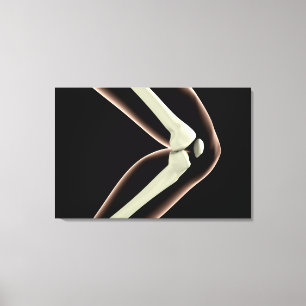 X-Ray Image Of Knee 1 Canvas Print