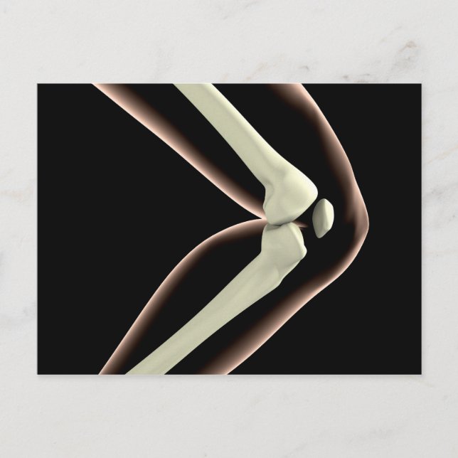 X-Ray Image Of Knee 1 Postcard (Front)