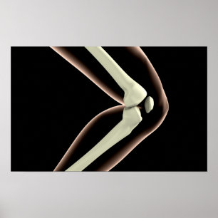 X-Ray Image Of Knee 1 Poster