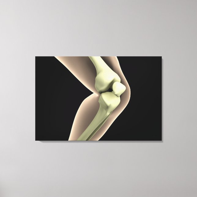 X-Ray Image Of Knee 2 Canvas Print (Front)