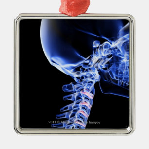 X-ray image of the bones of the neck metal ornament