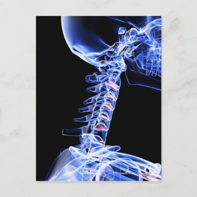 X-ray image of the bones of the neck postcard (Front)