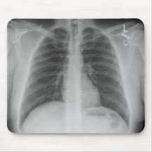 X-Ray Mousepad
