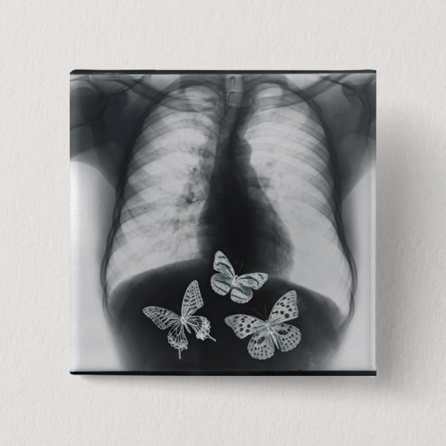 X-ray of butterflies in the stomach 2 inch square button (Front)