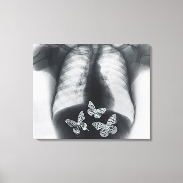 X-ray of butterflies in the stomach canvas print (Front)