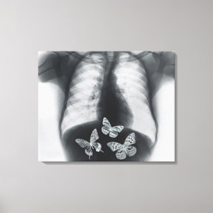 X-ray of butterflies in the stomach canvas print