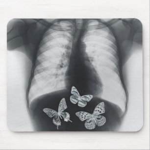 X-ray of butterflies in the stomach mouse pad