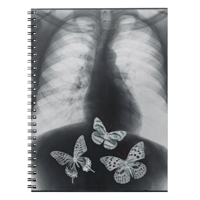 X-ray of butterflies in the stomach notebook (Front)