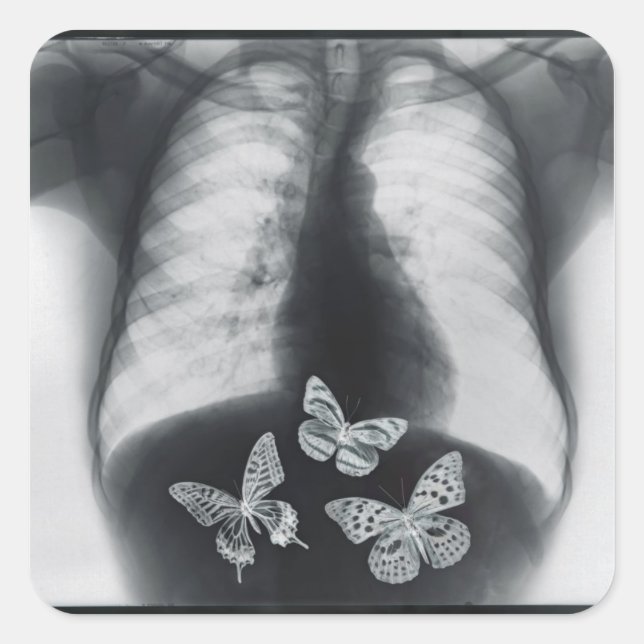 X-ray of butterflies in the stomach square sticker (Front)