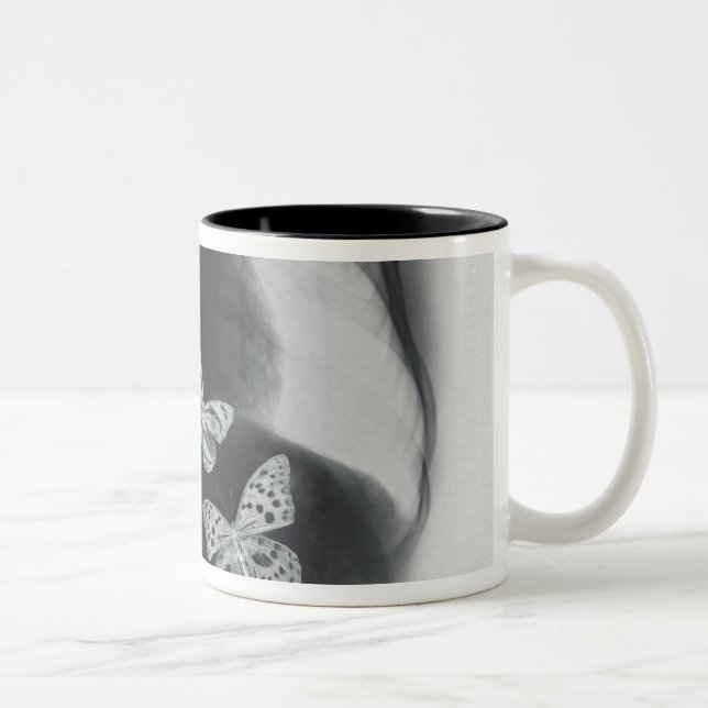X-ray of butterflies in the stomach Two-Tone coffee mug (Right)