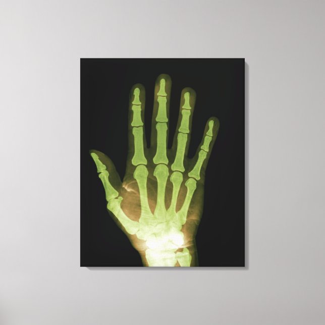X-ray of Human Hand Canvas Print (Front)