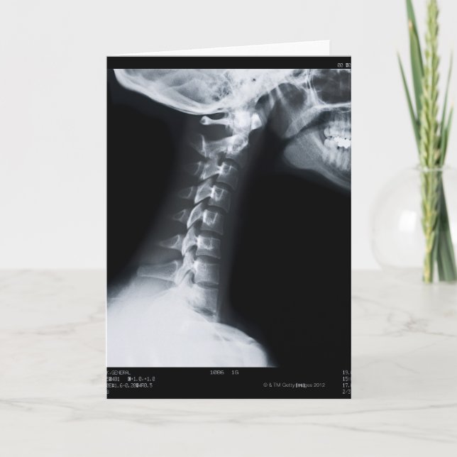 X ray of neck vertebrae including lower jaw card (Front)