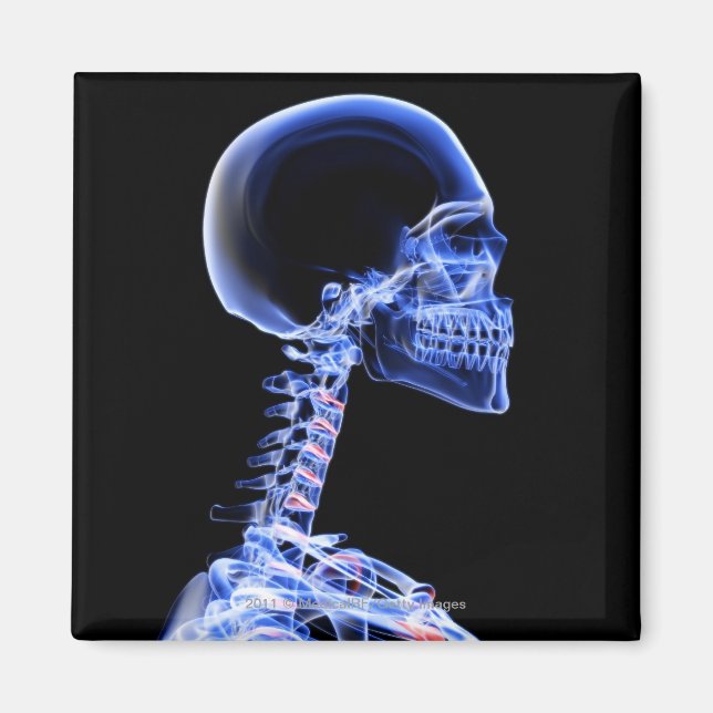 X-ray of the bones in the neck magnet (Front)