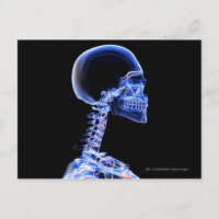 X-ray of the bones in the neck
