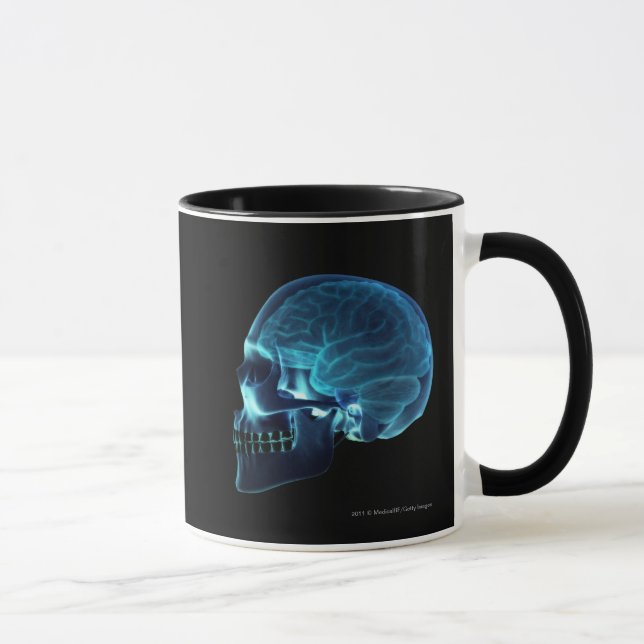 X-ray of the brain inside a skull mug (Right)