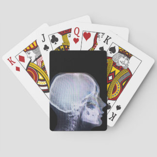 X-Ray Playing Cards