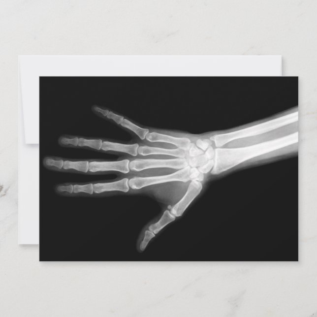 X-Ray Skeleton Arms Black & White Invitation (Front)