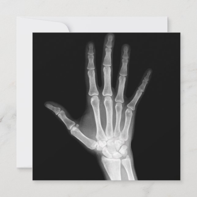 X-Ray Skeleton Arms Black & White Invitation (Front)