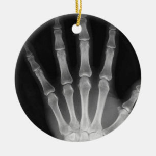 X-RAY SKELETON HAND FINGERS B&W CERAMIC ORNAMENT