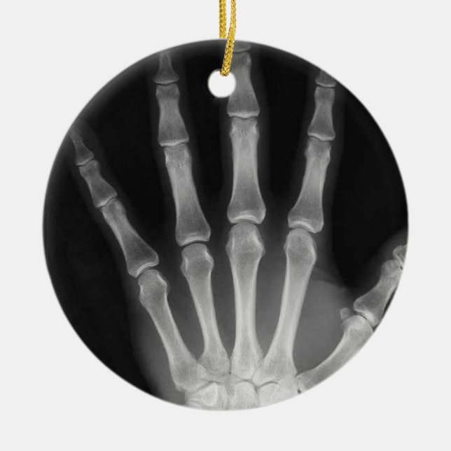 X-RAY SKELETON HAND FINGERS B&W CERAMIC ORNAMENT (Front)