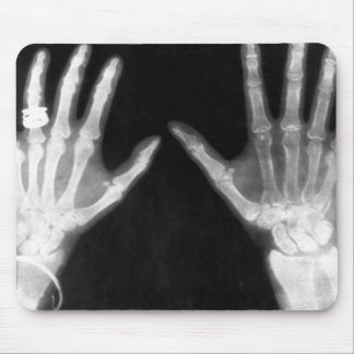 X-Ray Skeleton Hands & Jewellery - B&W Mouse Pad