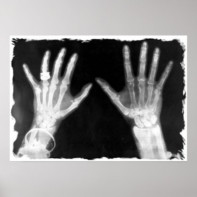 X-Ray Skeleton Hands & Jewellery - B&W Poster (Front)