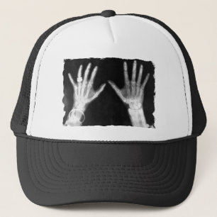 X-Ray Skeleton Hands & Jewellery - B&W Trucker Hat