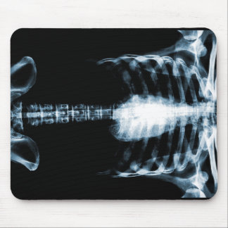 X-RAY SKELETON TORSO RIBS - BLUE MOUSE PAD