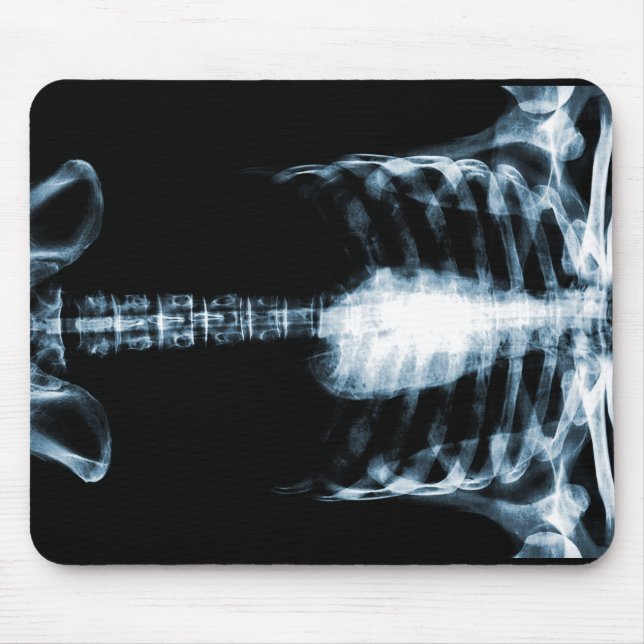 X-RAY SKELETON TORSO RIBS - BLUE MOUSE PAD (Front)
