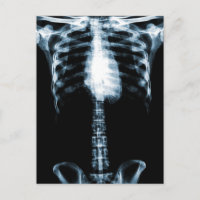 X-RAY SKELETON TORSO RIBS BLUE
