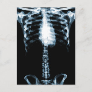 X-RAY SKELETON TORSO RIBS BLUE POSTCARD
