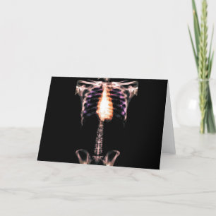 X-RAY SKELETON TORSO RIBS ORIGINAL CARD