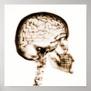 X-RAY SKULL BRAIN - ORANGE POSTER