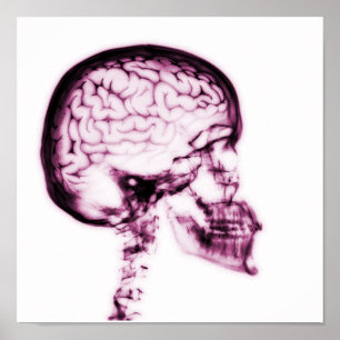 X-RAY SKULL BRAIN - PINK POSTER
