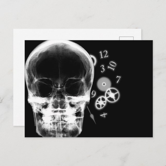 X-Ray Skull & Clock Parts - B&W Postcard (Front/Back)