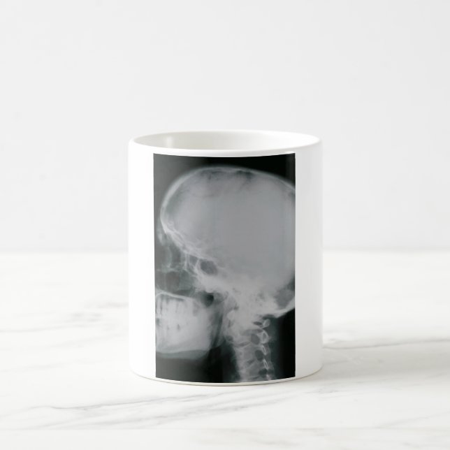 X-Ray Skull Magic Mug (Center)