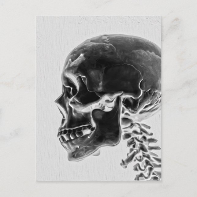 X-Ray Skull Postcard (Front)