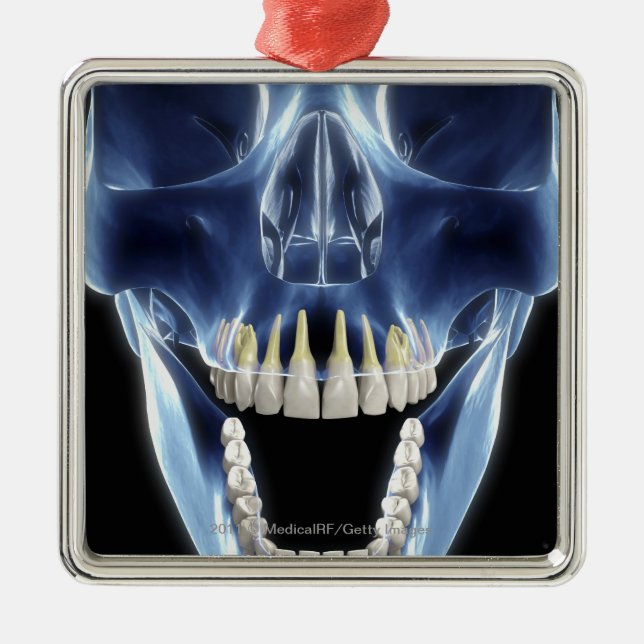 X-ray style look at human teeth metal ornament (Front)