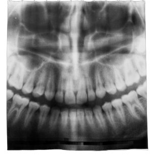X-Ray Teeth Mouth Smile Black and White
