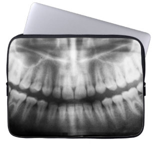 X-Ray Teeth Mouth Smile Black and White Laptop Sleeve