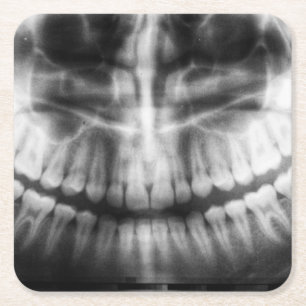 X-Ray Teeth Mouth Smile Black and White Square Paper Coaster
