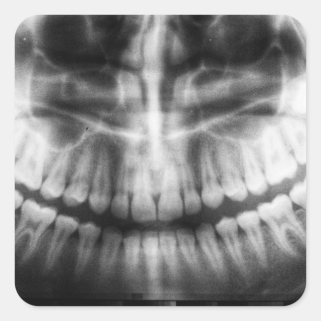X-Ray Teeth Mouth Smile Black and White Square Sticker (Front)