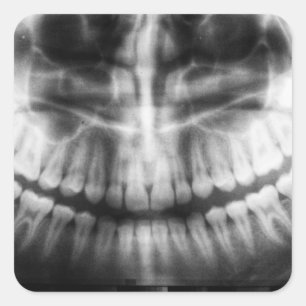 X-Ray Teeth Mouth Smile Black and White Square Sticker