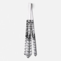 X-ray tie