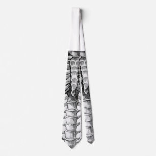 X-ray tie
