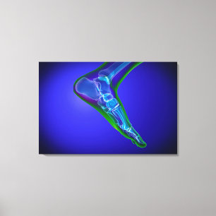 X-Ray View Of Human Foot 1 Canvas Print