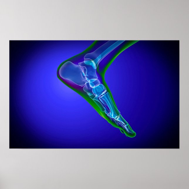 X-Ray View Of Human Foot 1 Poster (Front)